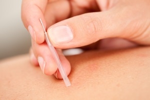 THE BACK CARE CLINIC